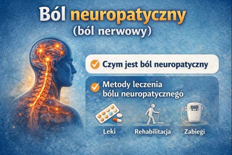 Ilustracja przedstawiająca ból neuropatyczny (ból nerwowy), jego przyczyny oraz metody leczenia, takie jak leki, rehabilitacja i leczenie zabiegowe