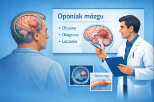 Oponiak – klasyfikacja oponiaków i schemat lokalizacji guza mózgu