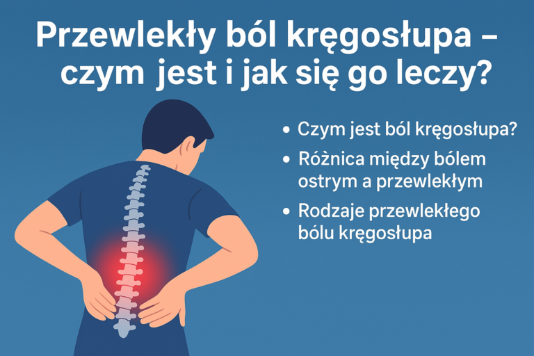 Przewlekły ból kręgosłupa – ilustracja przedstawiająca przykłady bólu kręgosłupa i jego objawów, zastosowana w artykule o definicji i leczeniu przewlekłego bólu kręgosłupa